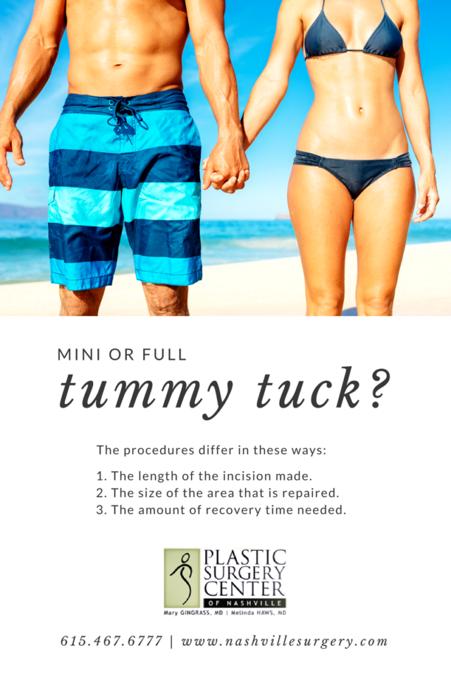 Difference Between a Full and Mini Tummy Tuck (Abdominoplasty)